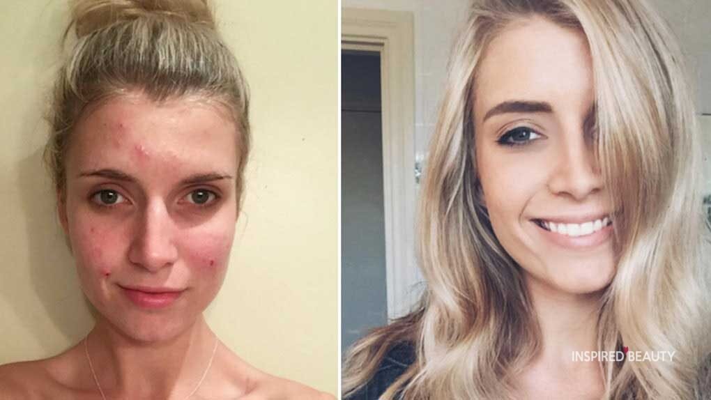 Before and After Makeup Transformation 20 photos